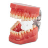 70752166 | EasyProp Disposable Mouth Props 100/Box