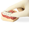 7039716 | Disposable Micro-Tray Impression Trays 50/Box | Disposable Micro-Tray Impression Trays save material and expense.