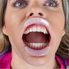 70103326 | Lip ring retractors expand oral access vertically.