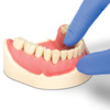 7160710 | Offers unique advantages for interproximal finishing.