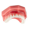 7163210 | DentXpin™ Intro Kit 10/Pack | Postpones or eliminates the use of traditional crowns, caps, or titanium pins with a more conservative, efficient, and aesthetically pleasing solution.