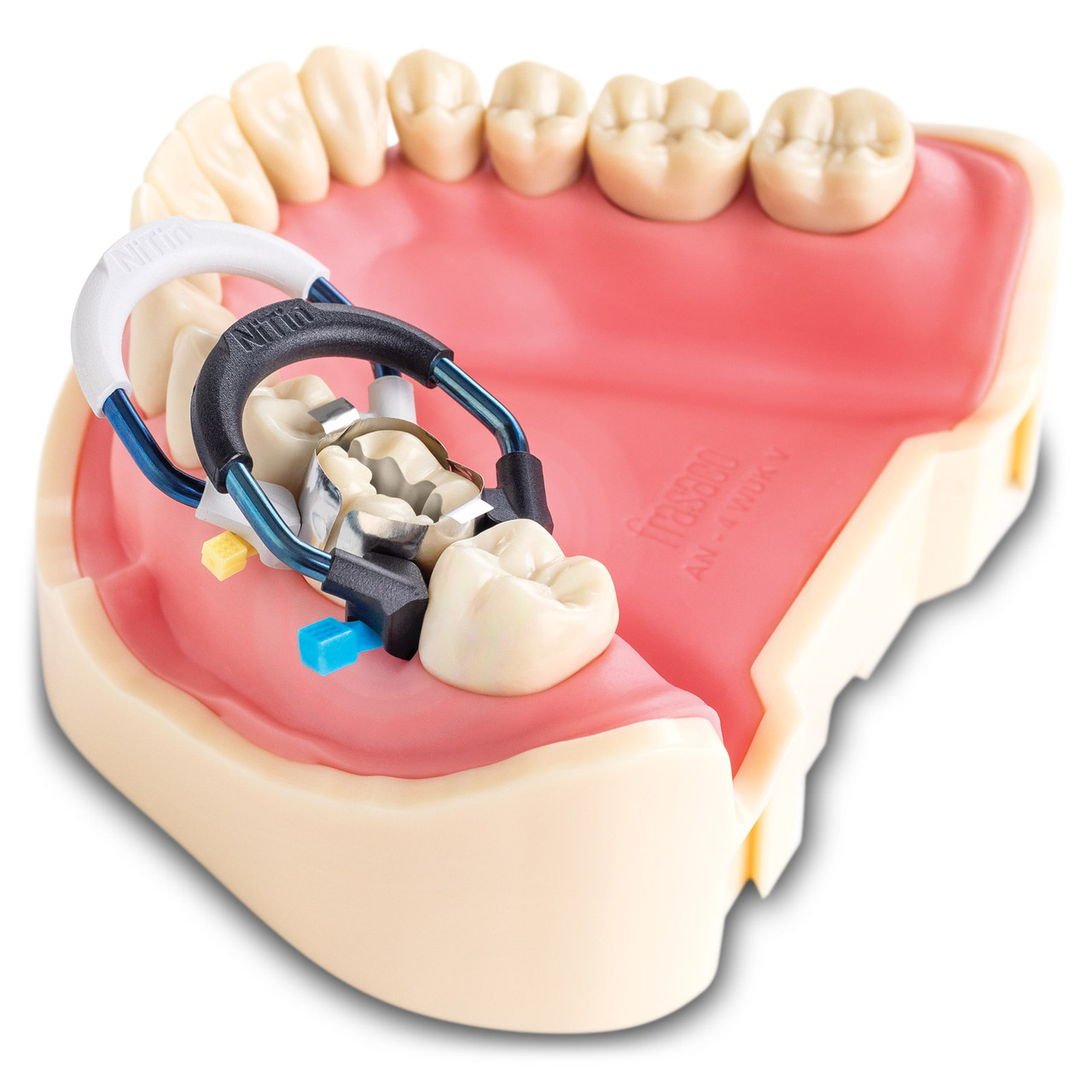 NiTin Sectional Matrix System Kit | Practicon Inc