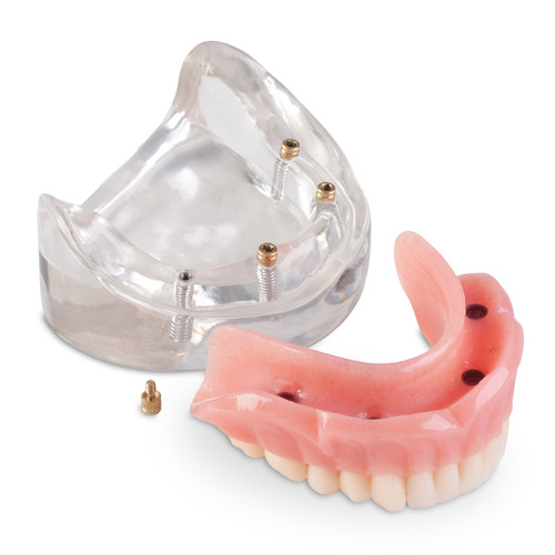 4056812 | LOC-4 Lower Locator Model