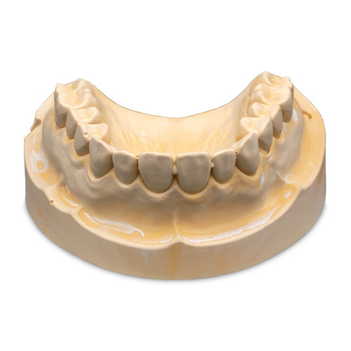 7125777 | Microstone 33 lb. Carton