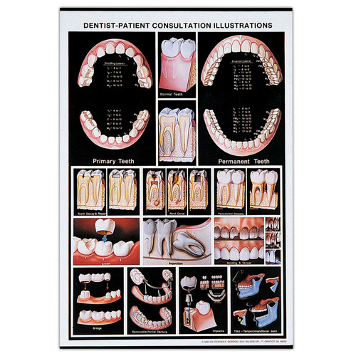 Consultation Illustrations Wall Chart 400918