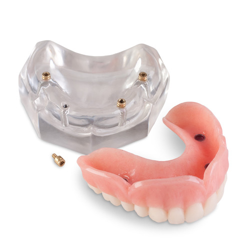 4056813 | ULOC-4 Upper Locator Model