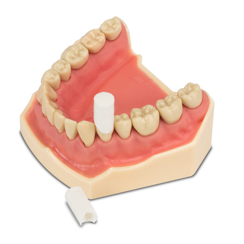 Retraction Cap Assortment 60/Pack | Practicon Inc