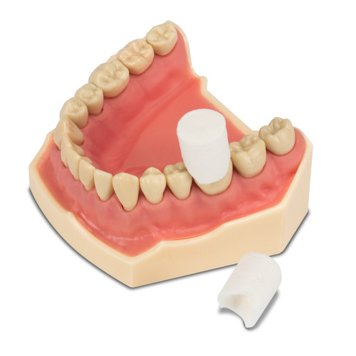 Premier Dental Products Size 5 Large Retraction Caps 60/Pack 70629131