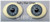 The sclera (white) are not tinted yellow.  I can't fix the photo.  They are bright white as normal.