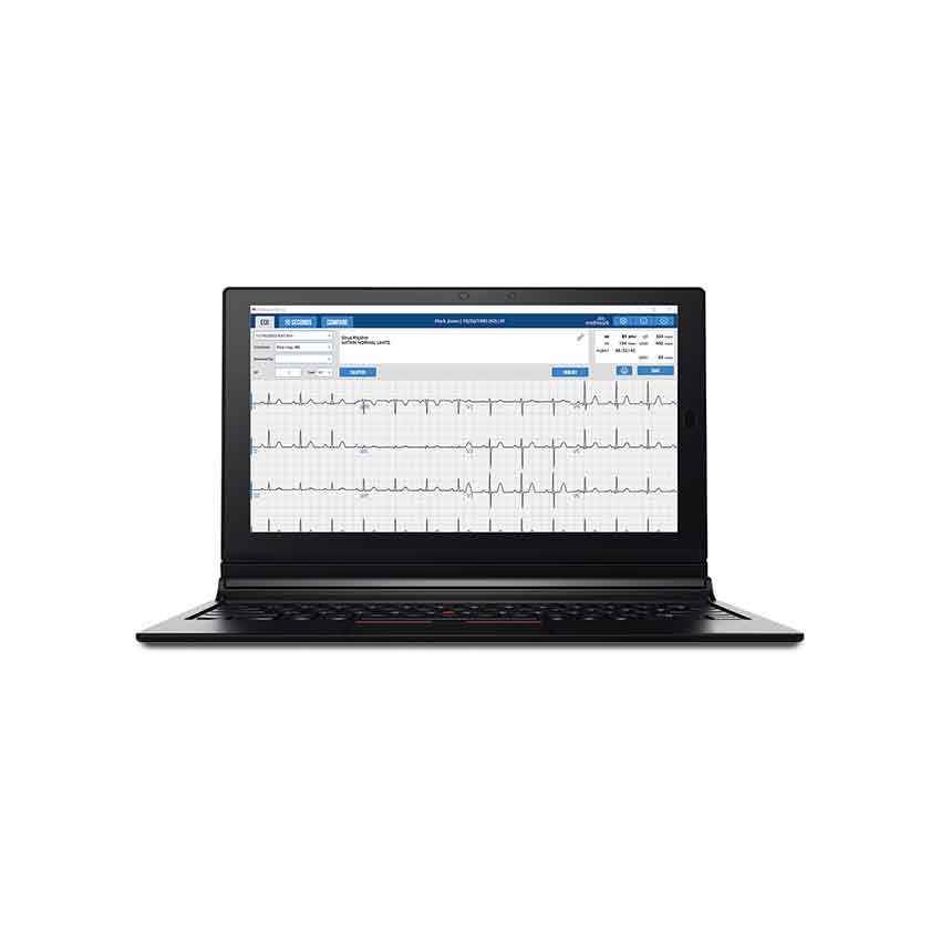 Midmark Digital IQ ECG With Lead Management Results 