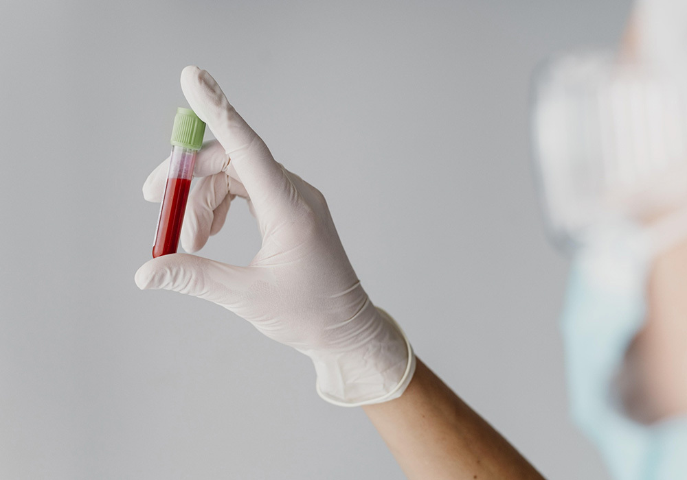 Análisis sangre en Farmacia Jesús Joaquín Gómez Abellán