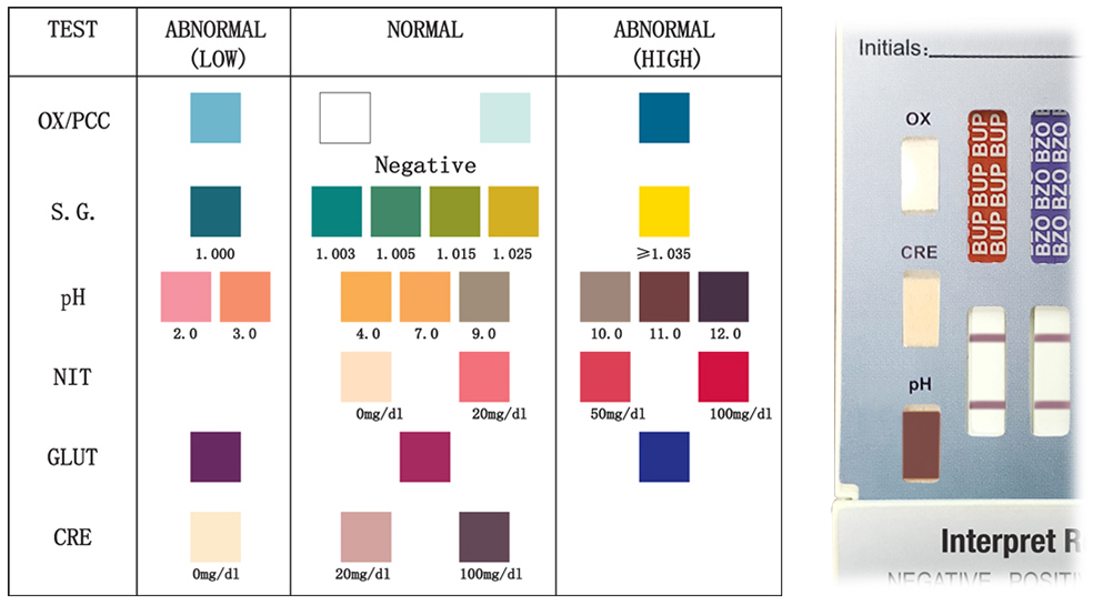 color chart for urine dip