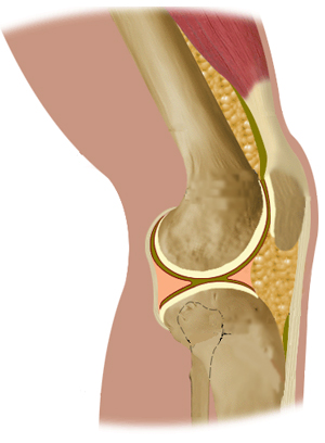 Plug-in Infrared Heat Therapy Knee Wrap