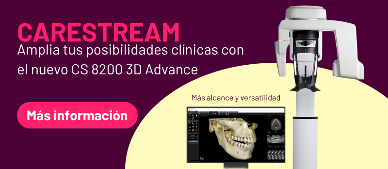 Blanqueamiento dental