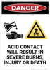 Danger: Acid Contact Will Result In Severe Burns - Wall Sign Danger: Acid Contact Will Result In Severe Burns - Wall Sign