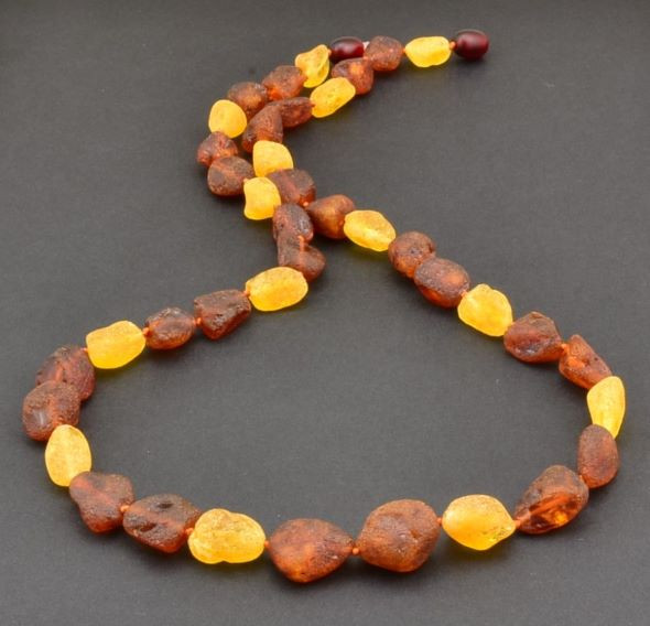 Amber Healing Necklace