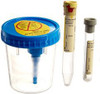 BD Vacutainer® Urine Specimen Collection Kit #364957