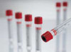 Vacuette® Z Serum Sep Clot Activator Venous Blood Collection Tube, 5 mL, 13 x 100 mm #456073P