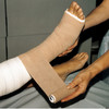 3M™ Coban™ Self-adherent Closure Cohesive Bandage, 6 Inch x 5 Yard #1586