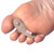 Pedifix Toe Crest Pad, for Medium Right Feet #8154A-MR