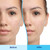 Differin Gel Acne Treatment #00299492030