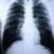 Clear Choice™ Performance X-Ray Film #55BN7