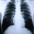 Clear Choice™ Performance X-Ray Film #55BTL