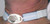 AirLife® Tracheostomy Tube Holder #RES242A