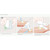 Mesalt® Sodium Chloride Impregnated Dressing, 4 x 4 Inch / 2 x 2 Inch Folded #285580