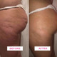 NEW! BIOSLIMMING WRAP KIT