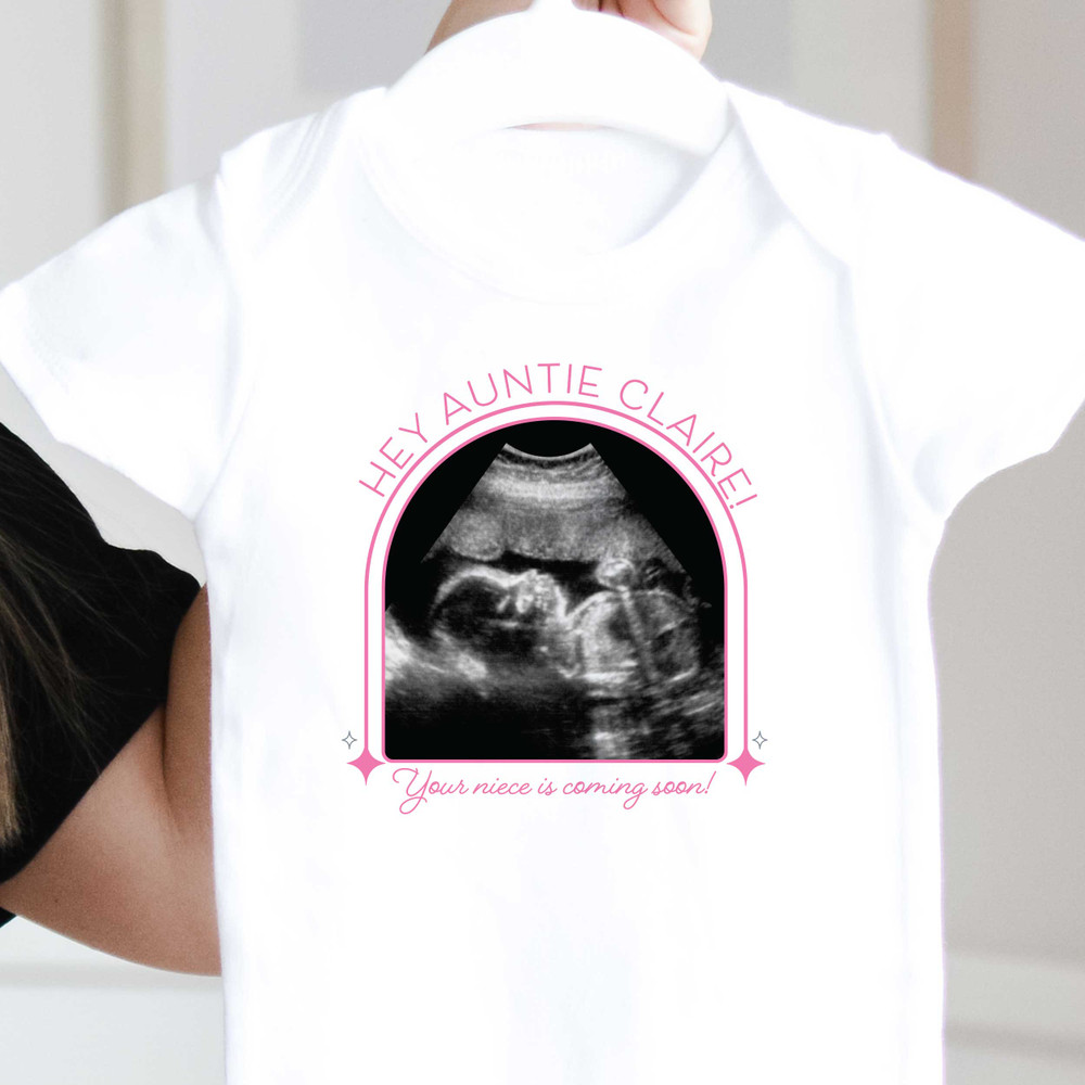 Ultrasound Baby Announcement