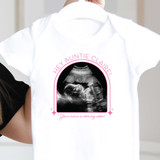 Ultrasound Baby Announcement
