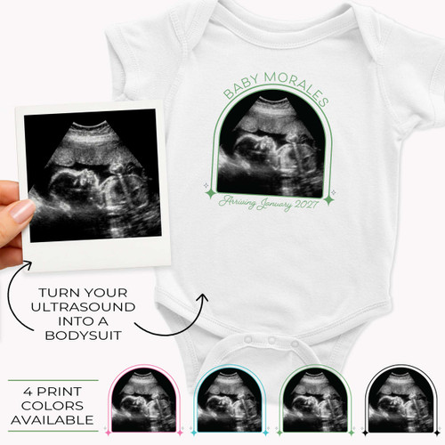 Ultrasound Baby Announcement