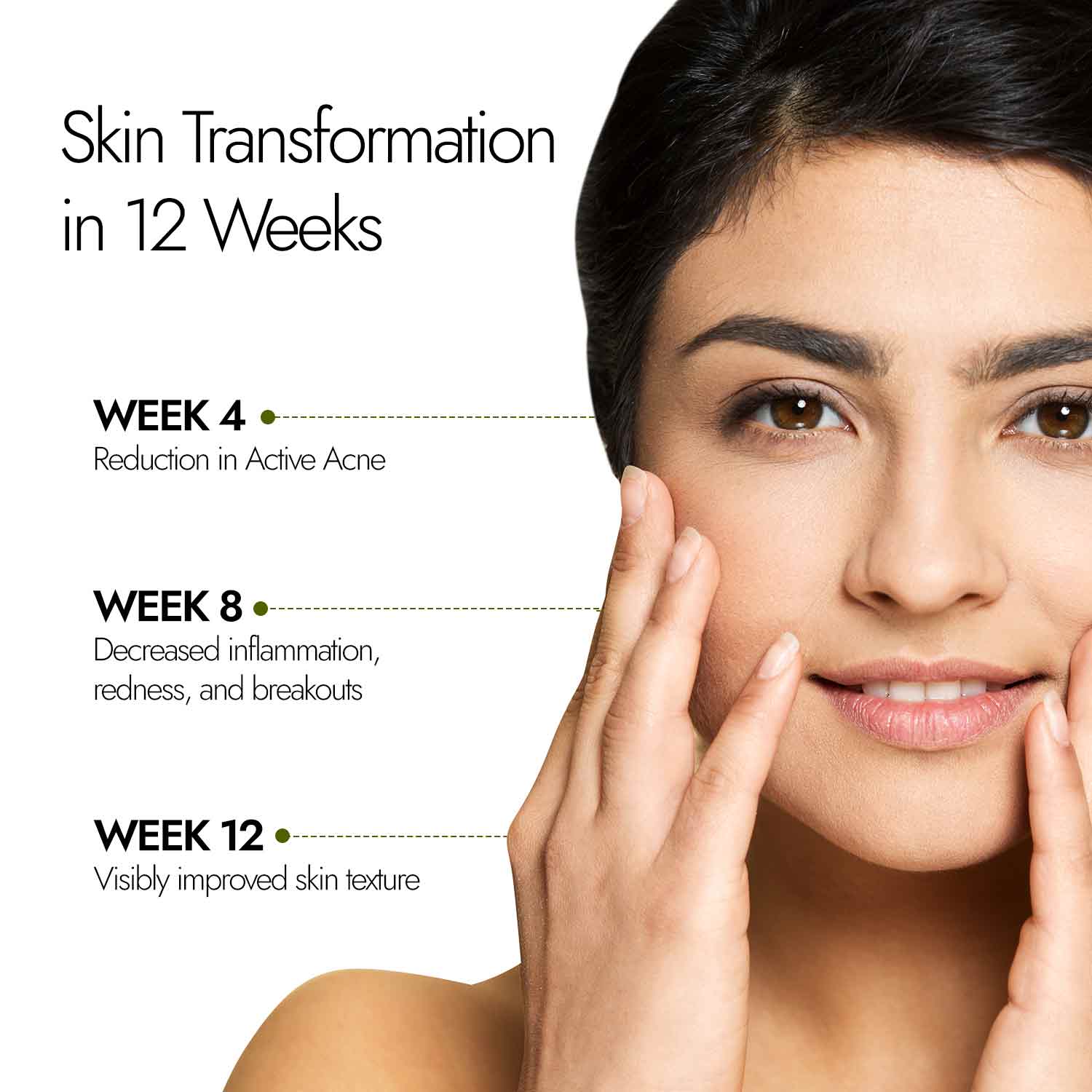 Acne Ease Fizz