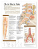 Understanding Low Back Pain Anatomical Chart