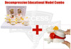 Decompression Educational Model Combo, 4 Stages of Degeneration, Decompression Spinal Disc Herniation Model, Degenerative Lumbar Vertebrae Disks Model, Decompression Educational Model, Decompression Educational Models, degenerative lumbar discs model, disc degeneration model, disc herniation model, Decompression Model, anatomical model Decompression Educational Model Combo, 4 Stages of Degeneration, Decompression Spinal Disc Herniation Model, Degenerative Lumbar Vertebrae Disks Model, Decompression Educational Model, Decompression Educational Models, degenerative lumbar discs model, disc degeneration model, disc herniation model, Decompression Model, anatomical model