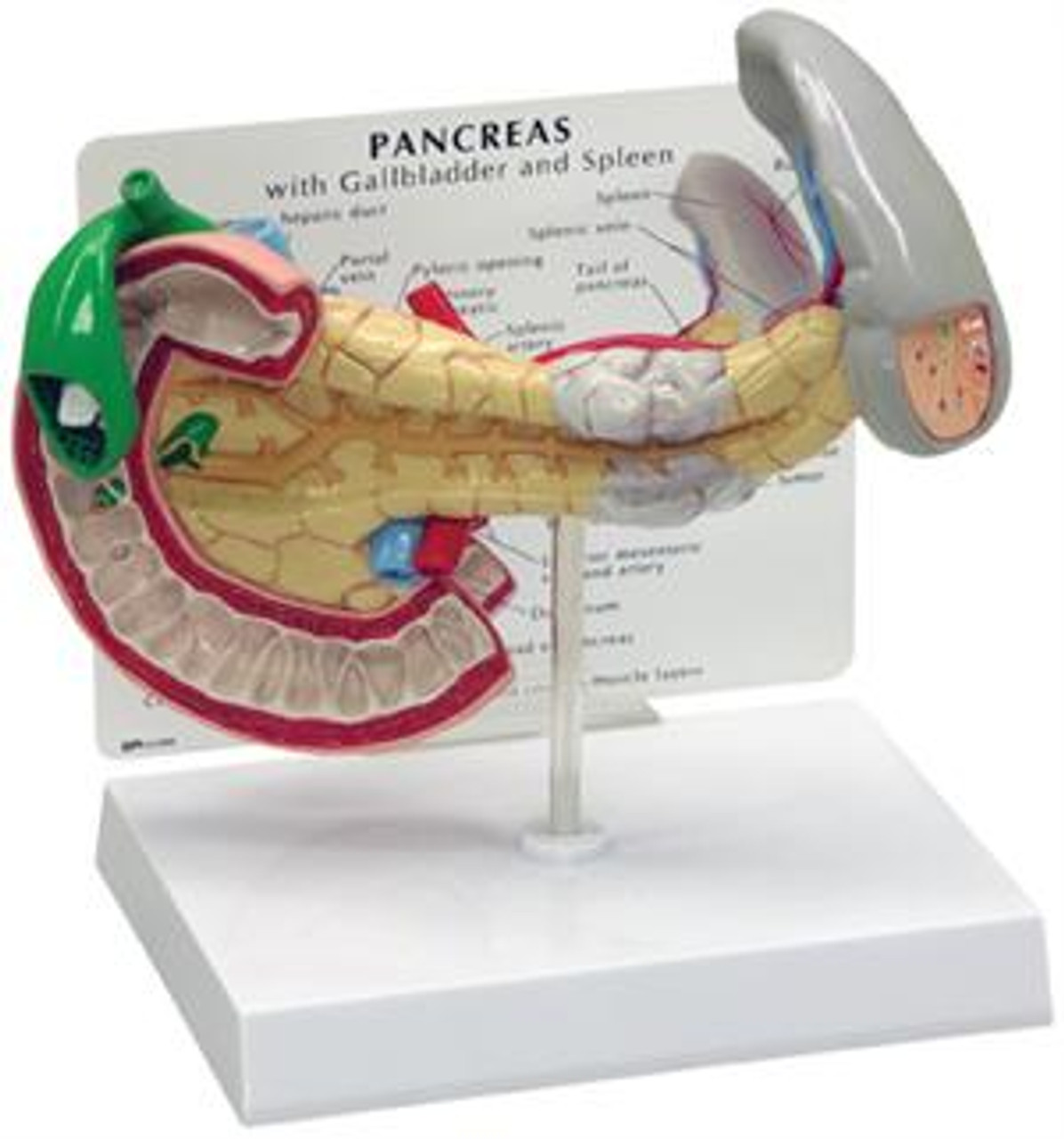Pancreas/Gallbladder/Spleen cancer model