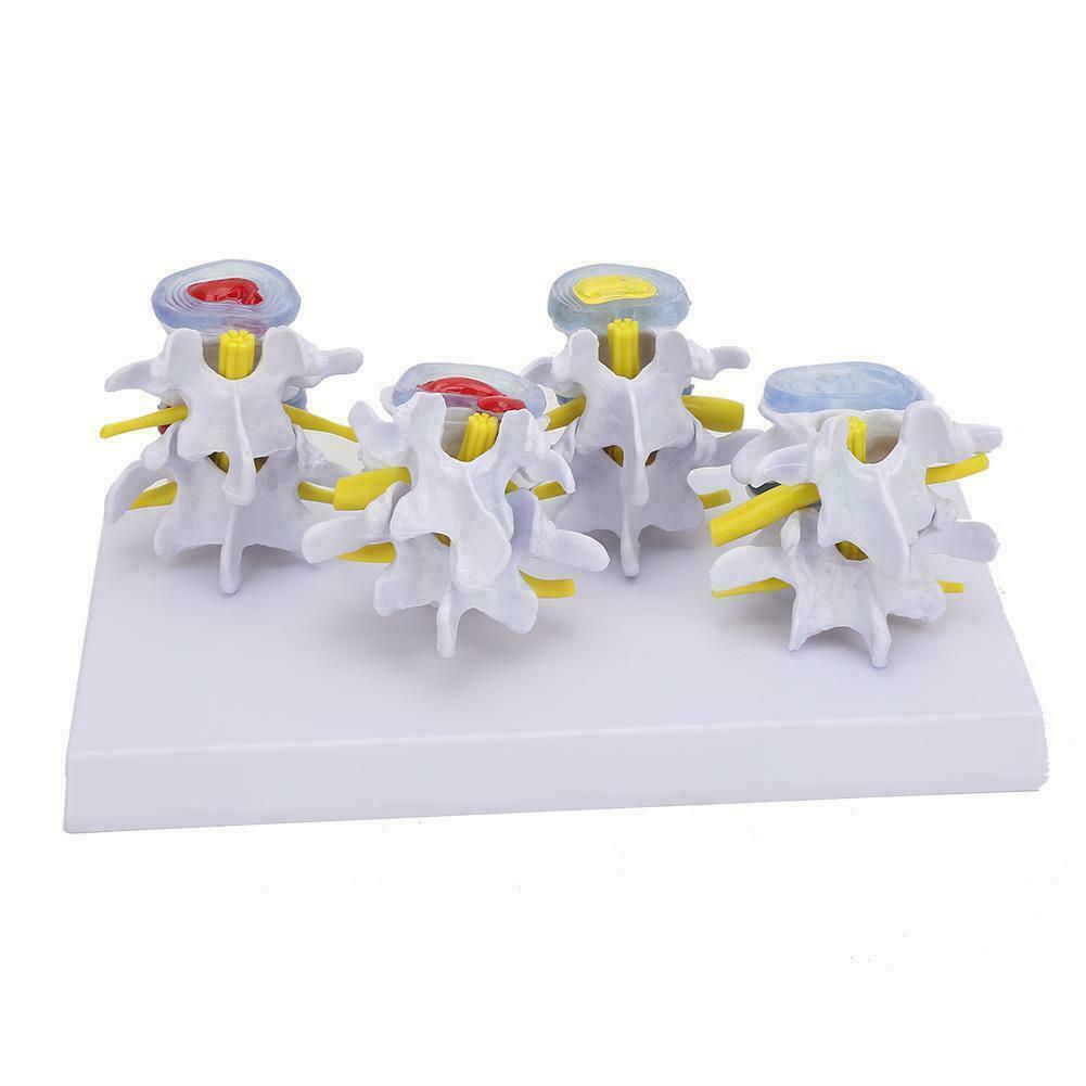 Vertebrae Models Vertebrae Models