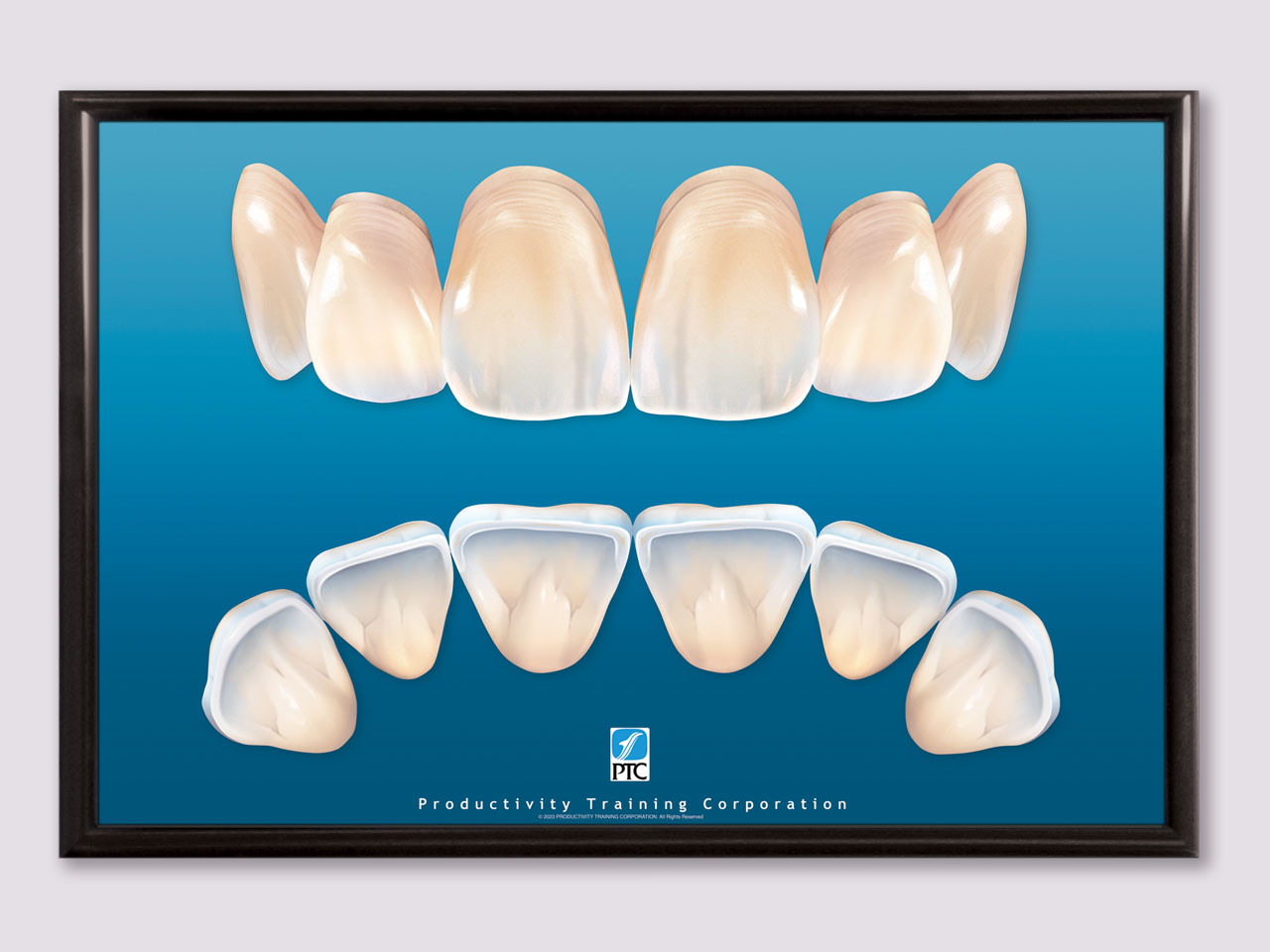 Anterior Teeth Dental Poster