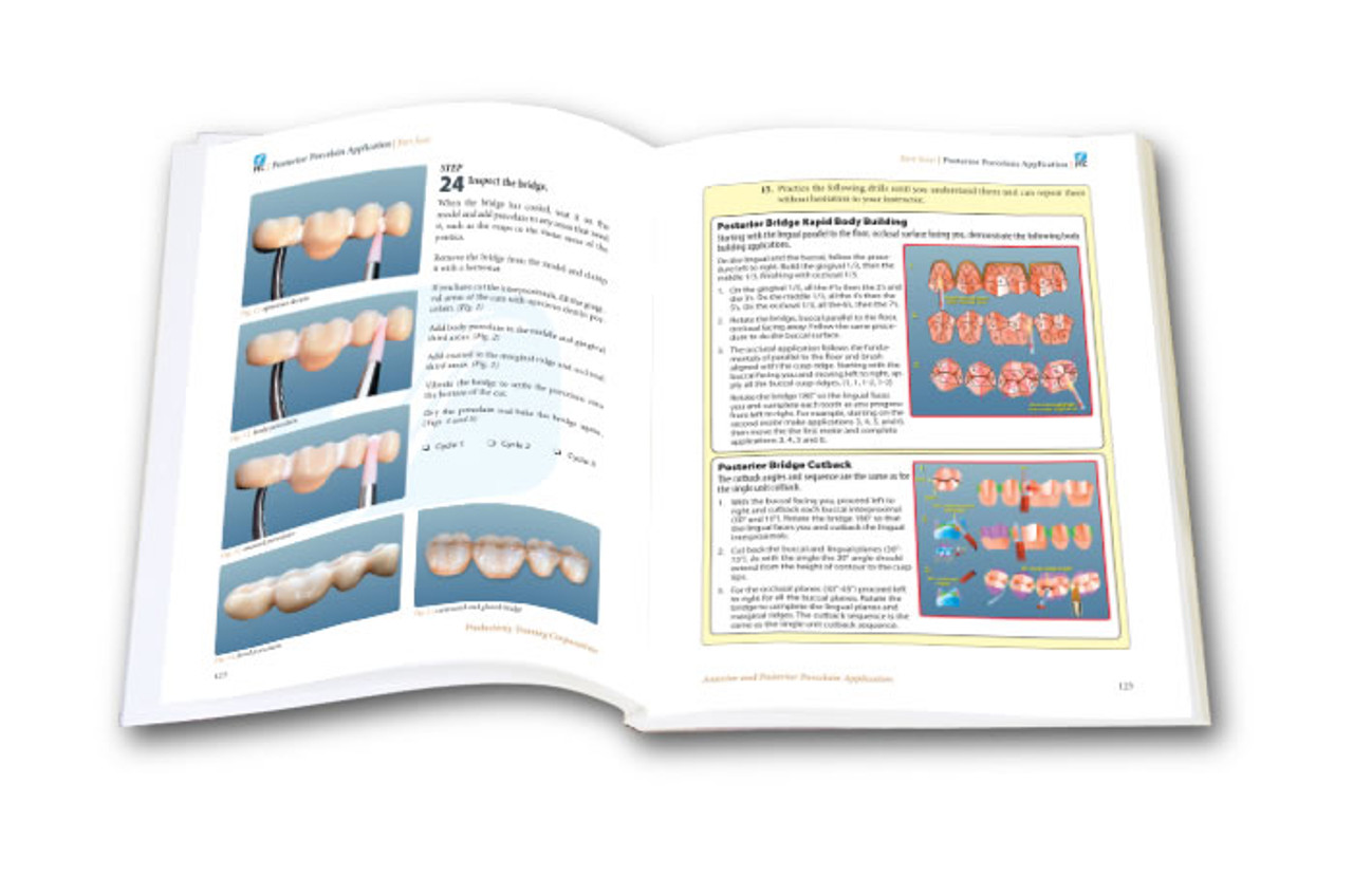 Anterior and Posterior Porcelain Application TechMaster Module