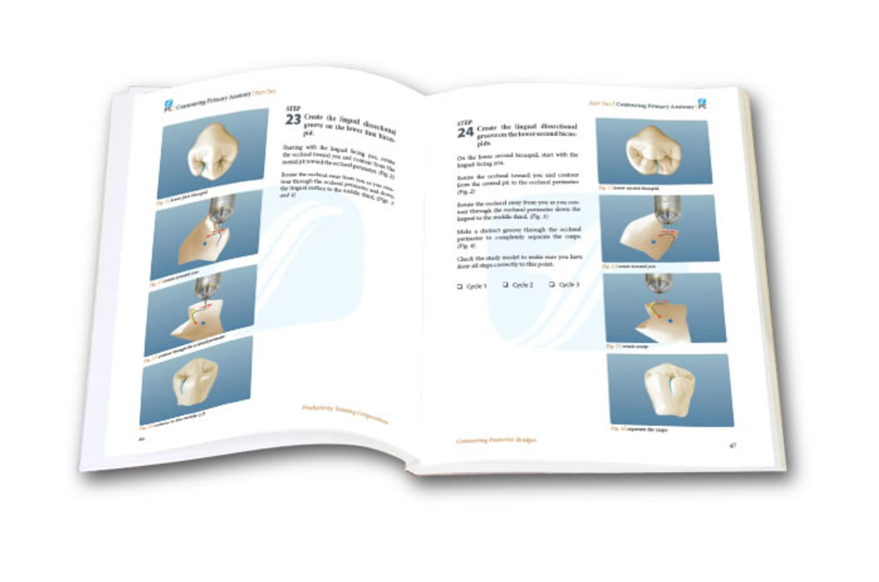 Contouring Posterior Bridges TechMaster Module