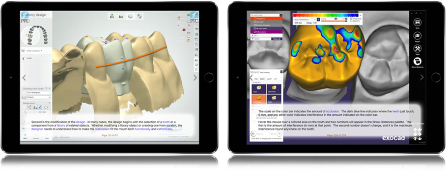 PTC 3Shape and exocad Training - Blue Dolphin Products