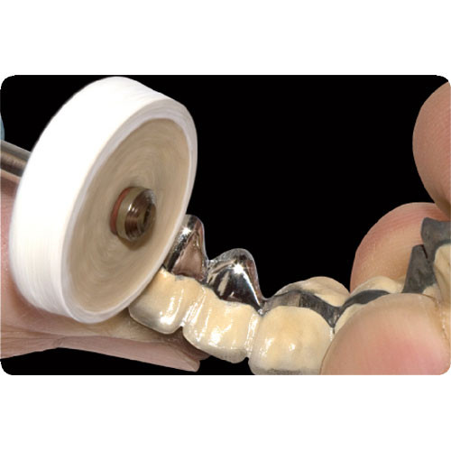 Crown and Bridge - Polishing - Blue Dolphin Products
