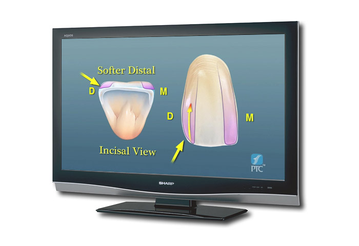 Anterior Dental Anatomy DVD