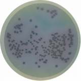 Introducing Pseudomonas Chromogenic Agar: The Latest Addition to Our Chromogenic Media Portfolio