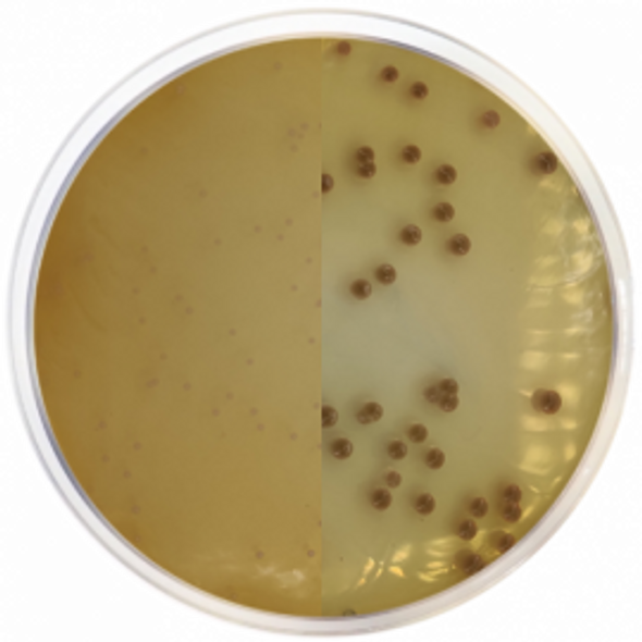 Chromogenic Agar Burkholderia Cepacia Chromogenic Agar Burkholderia Cepacia