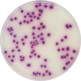 Salmonella Chromogenic Agar