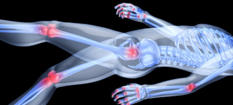Inflammation: How and Why It Affects You