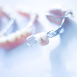 Secure & Denture Partials FAQ's