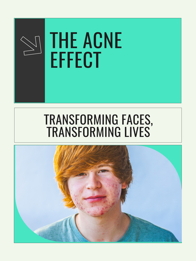 Acne Filter Effect The Acne Effect - ebook